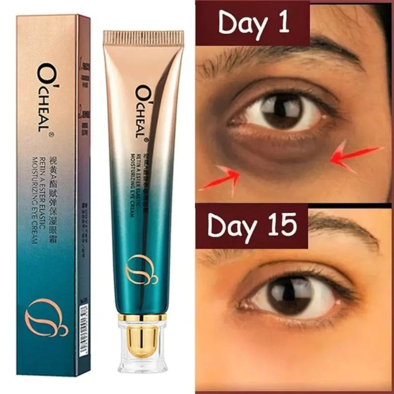 New Anti-Wrinkle Eye Cream - Youthful, Radiant Eyes