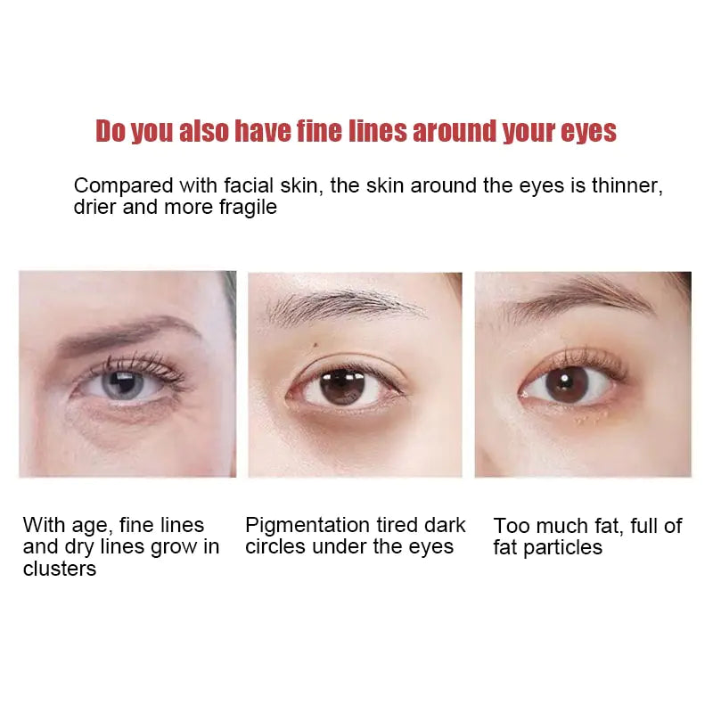 New Anti-Wrinkle Eye Cream - Youthful, Radiant Eyes