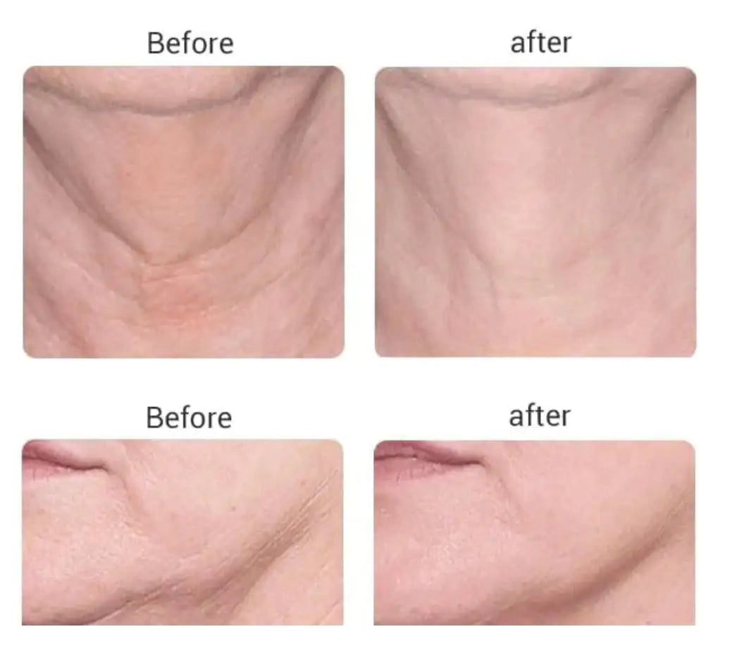 Beauty Microcurrent Facial Toning Massager - Lift, Firm, and Enhance Skin Glow