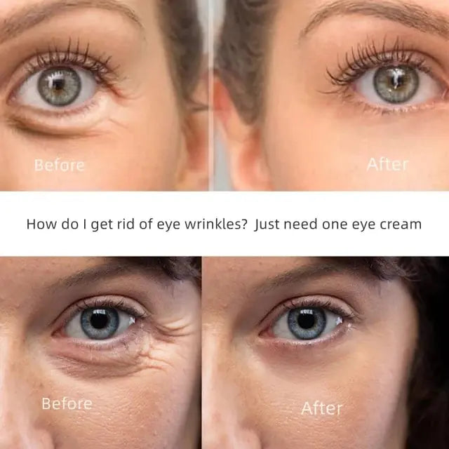 New Anti-Wrinkle Eye Cream - Youthful, Radiant Eyes