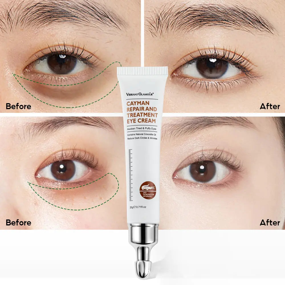 Peptide Collagen Eye Cream - Revitalize and Rejuvenate Your Eyes