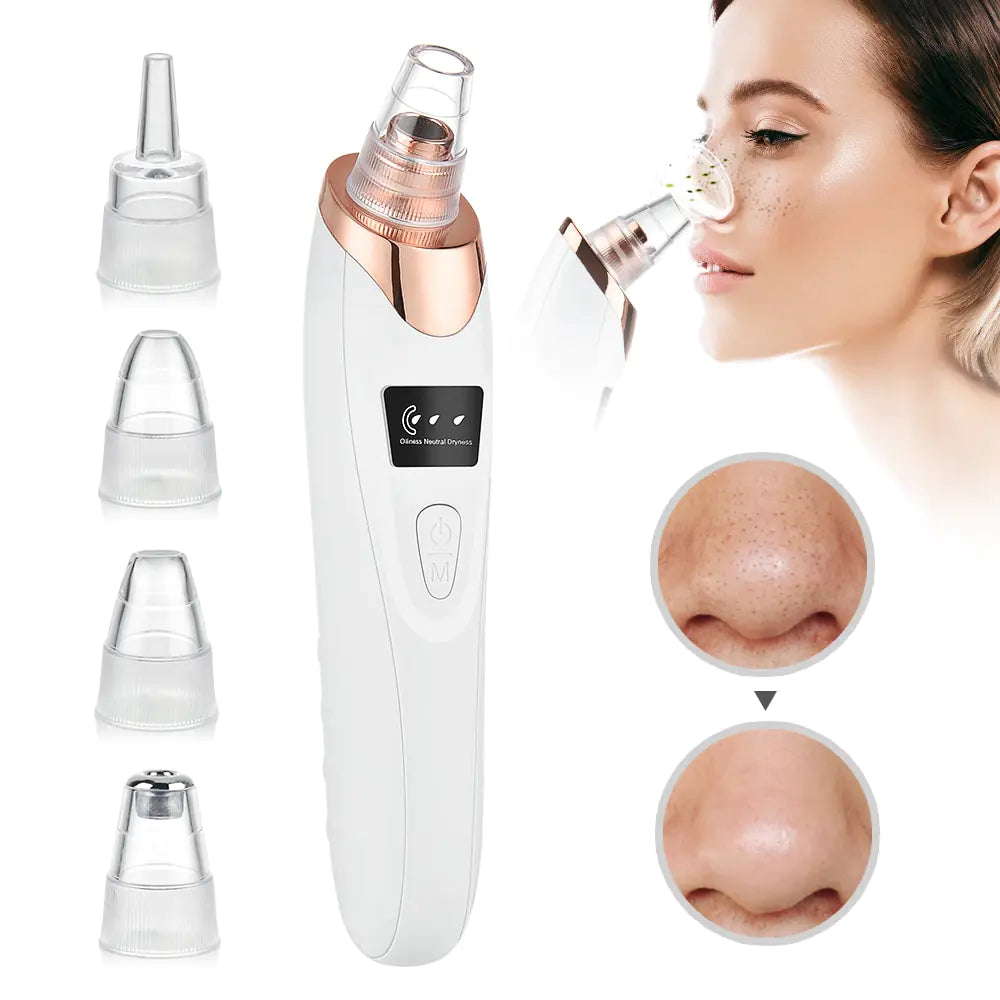 Beauty Electric Blackhead Remover - Gentle Vacuum Suction for Clearer Skin