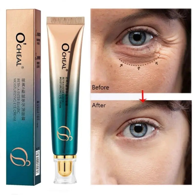 New Anti-Wrinkle Eye Cream - Youthful, Radiant Eyes