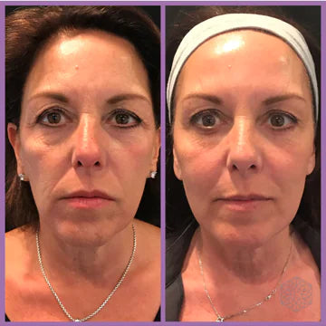 Beauty Microcurrent Facial Toning Massager - Lift, Firm, and Enhance Skin Glow