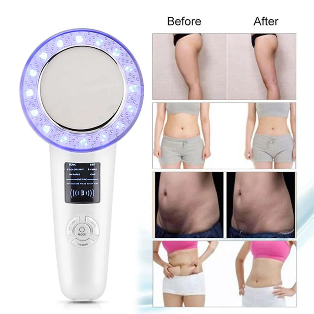 6-in-1 EMS Body Slimming Massager - RF Ultrasonic Cavitation & Anti-Cellulite Fat Burner