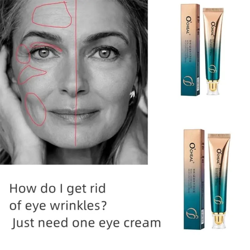 New Anti-Wrinkle Eye Cream - Youthful, Radiant Eyes