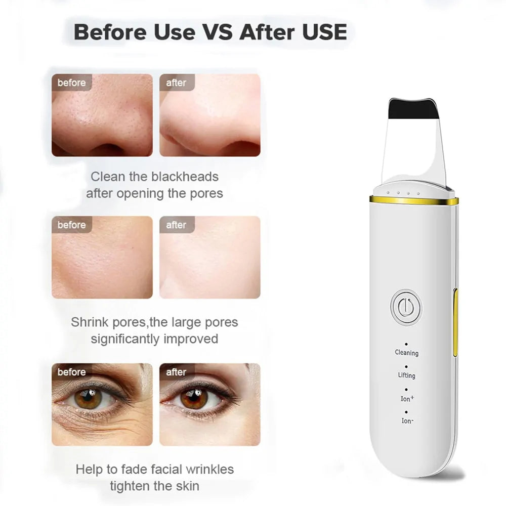 Beauty Ultrasonic Skin Scrubber - Radiant, Glowing Skin