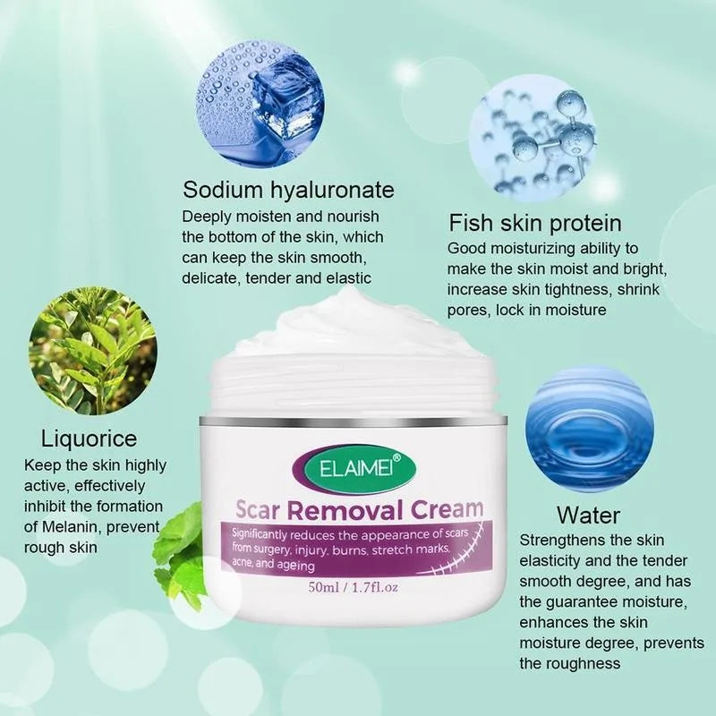 Scar Removal Cream - Achieve Smoother, Radiant Skin