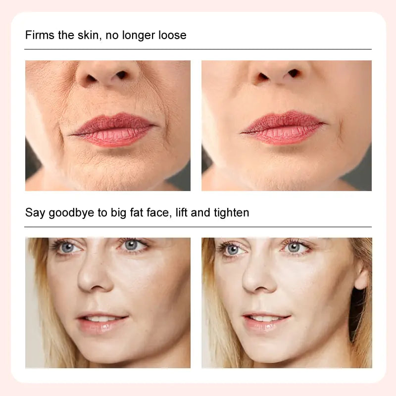 Face-Lift Cream - Achieve a Youthful, Sculpted Look