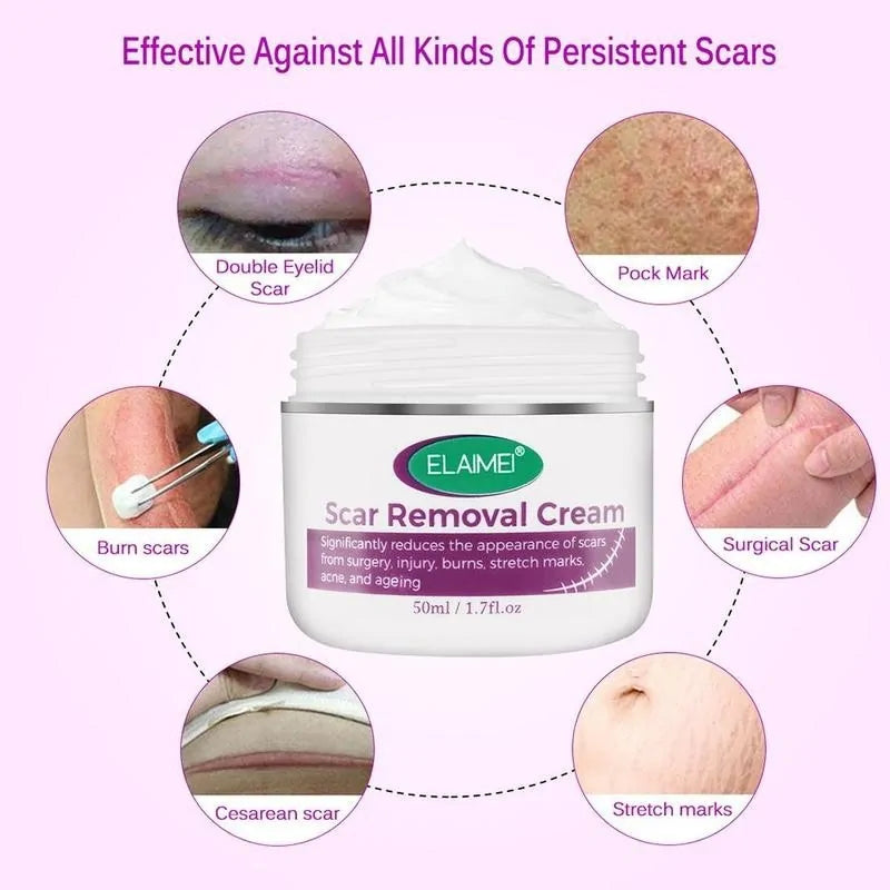 Scar Removal Cream - Achieve Smoother, Radiant Skin